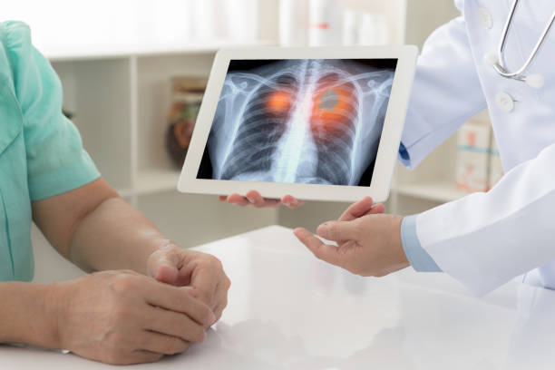 Долгая жизнь: как регулярные обследования помогают победить рак лёгкого
